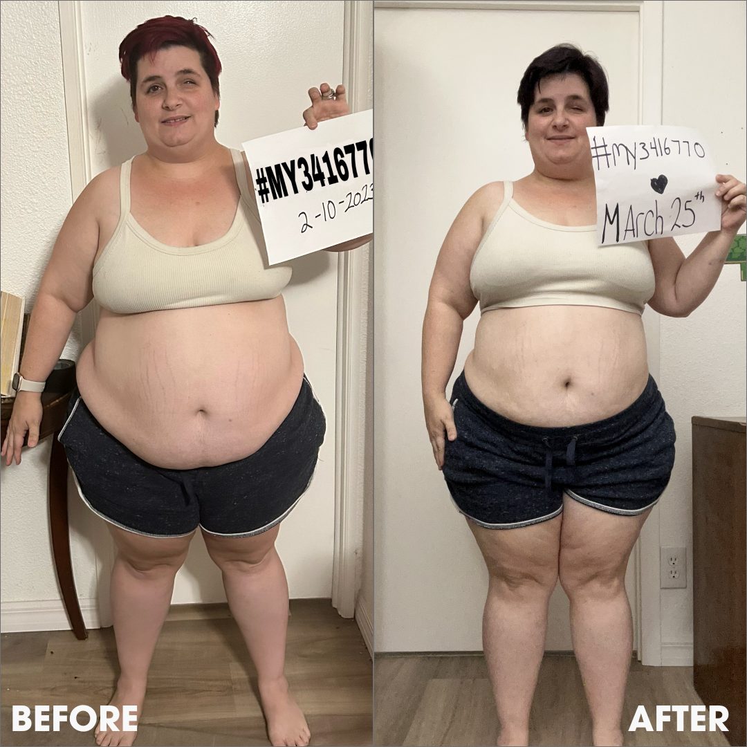Before and after transformation photos from a real Obvi community member