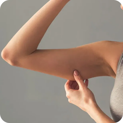 ARMS AND LEGS LOSING TONE FASTER THAN EXPECTED