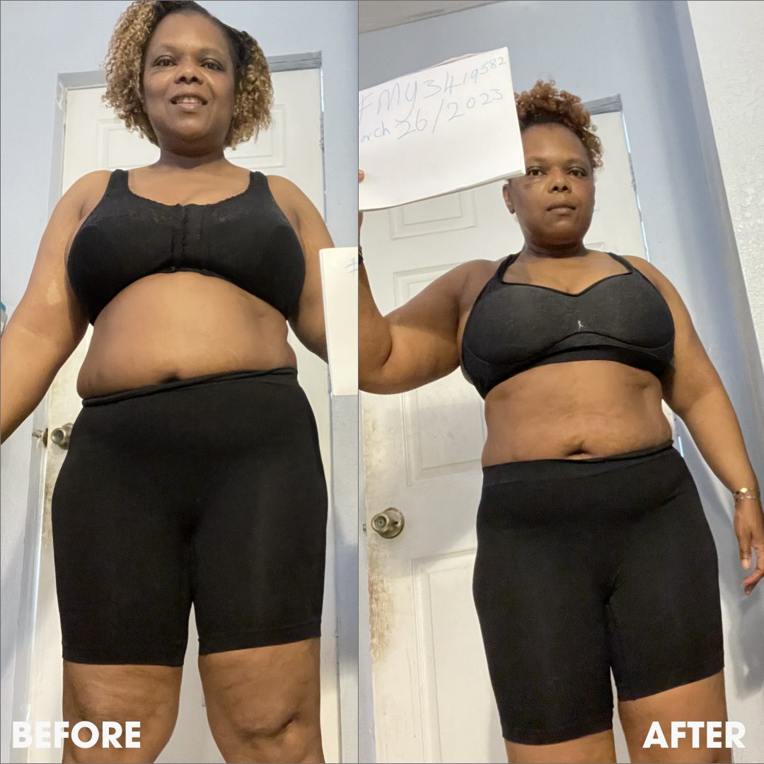 Before and after transformation photos from a real Obvi community member