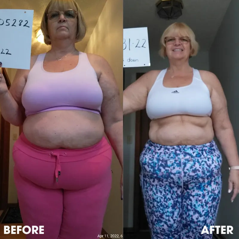 Before and after transformation photos from a real Obvi community member